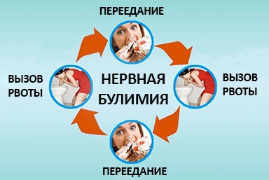 Лечение булимии в Полазне